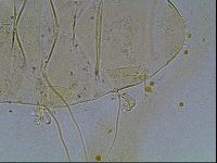Echiniscus blumi image