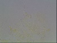Echiniscus blumi image