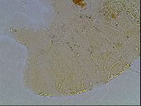 Media resource of Echiniscus blumi