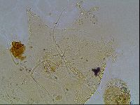 Echiniscus blumi image