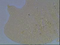 Echiniscus blumi image