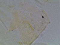 Echiniscus blumi image