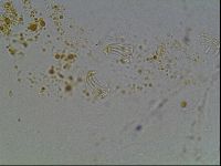 Echiniscus blumi image