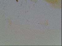 Echiniscus blumi image