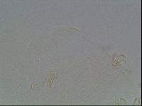 Echiniscus blumi image