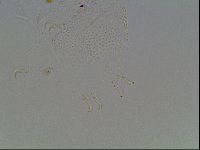 Echiniscus blumi image