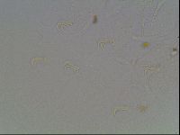 Echiniscus blumi image