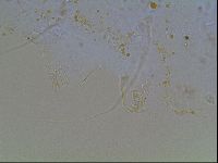 Echiniscus blumi image
