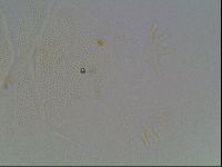 Echiniscus blumi image