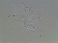 Echiniscus blumi image