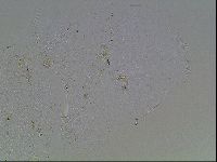Echiniscus blumi image