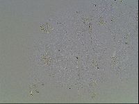 Echiniscus blumi image