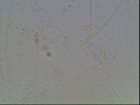 Echiniscus blumi image