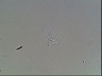 Echiniscus blumi image