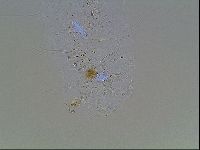 Echiniscus blumi image