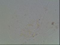 Echiniscus blumi image