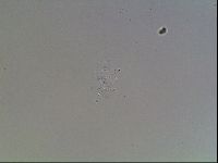 Echiniscus blumi image