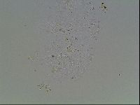 Echiniscus blumi image