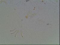 Echiniscus blumi image