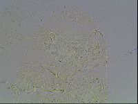 Echiniscus blumi image