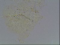Echiniscus blumi image