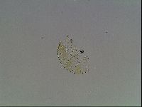 Echiniscus blumi image