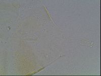 Echiniscus blumi image