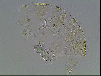 Echiniscus blumi image