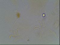 Echiniscus blumi image