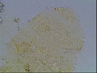 Echiniscus blumi image