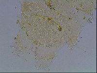 Echiniscus blumi image
