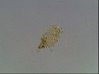 Echiniscus blumi image