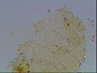 Echiniscus blumi image