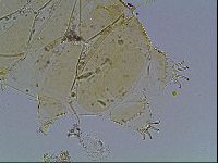 Echiniscus blumi image