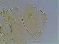 Echiniscus blumi image