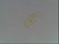 Echiniscus blumi image