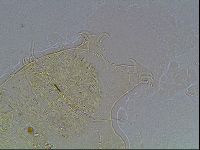 Echiniscus blumi image