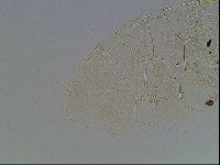 Echiniscus blumi image