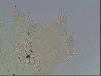 Echiniscus blumi image