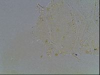 Echiniscus blumi image