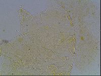Echiniscus blumi image