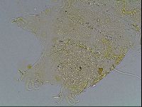Echiniscus blumi image