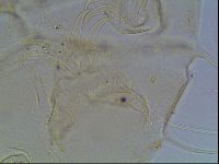 Echiniscus blumi image