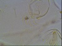 Echiniscus blumi image