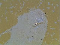Echiniscus blumi image