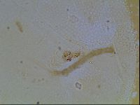 Echiniscus blumi image