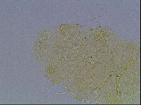 Echiniscus blumi image
