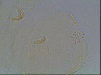 Echiniscus blumi image