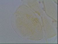 Echiniscus blumi image