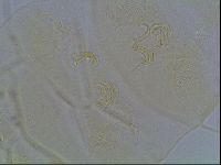 Echiniscus blumi image